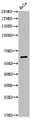 Acetyl-RELA (K310) Antibody