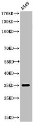 Acetyl-APEX1 (K6) Antibody