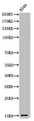 Acetyl-Histone H2B (K126) Antibody