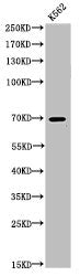 Acetyl-TP73 (K321) Antibody