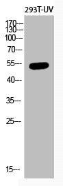 Acetyl-TP53 (K382) Antibody