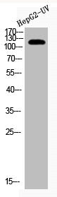 Acetyl-XPO1 (K568) Antibody