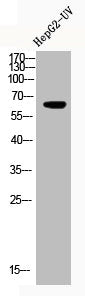 Acetyl-RELA (K122) Antibody