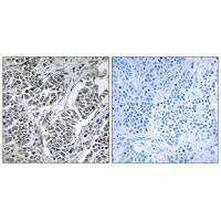ATP5D Antibody