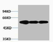 VIM Antibody