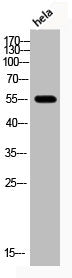 Phospho-AKT1/AKT2/AKT3 (T308) Antibody