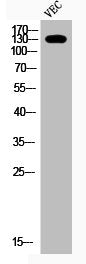 Phospho-IRS1 (S307) Antibody