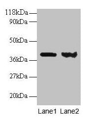 ARHGDIA Antibody