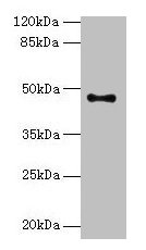 AADACL2 Antibody
