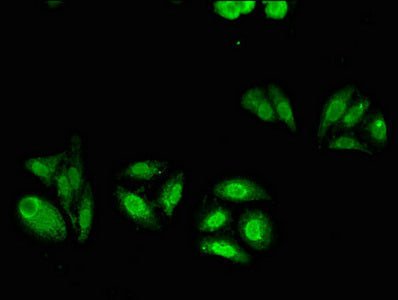 ABCC4 Antibody