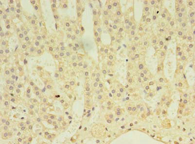 ABLIM3 Antibody
