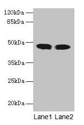 ACADL Antibody