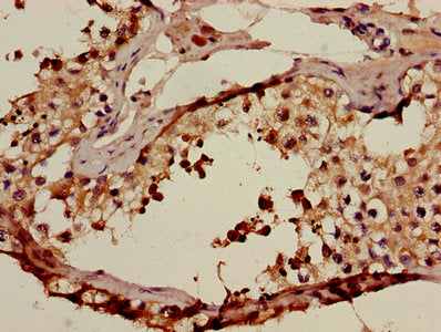 ACRV1 Antibody