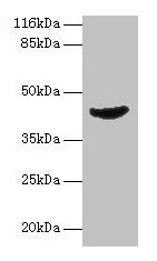 ADA Antibody