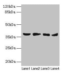 AKR1C2 Antibody