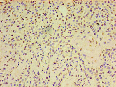 ARF6 Antibody