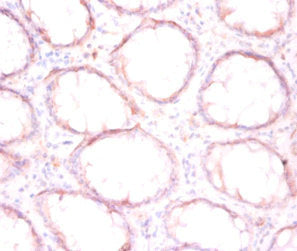 P4HB Antibody