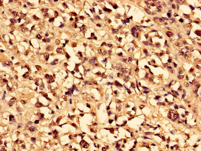 CA1 Antibody