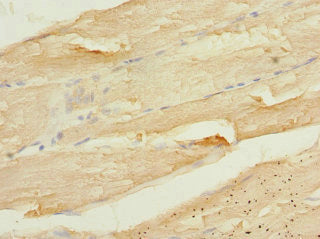 CALU Antibody