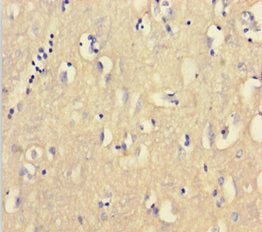 CNBP Antibody