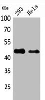IDH1 Antibody
