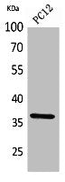 F11R Antibody