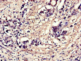 EIF4A3 Antibody