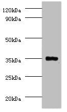 PPP2CB Antibody