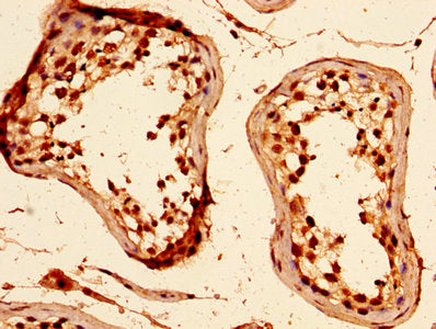HIST1H1C (Ab-89) Antibody