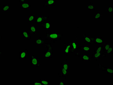 HIST1H1C (Ab-51) Antibody
