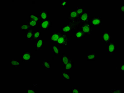 2-hydroxyisobutyryl-HIST1H1C (K63) Antibody