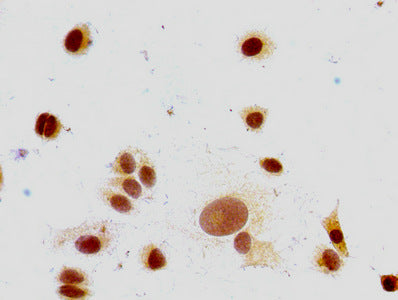 Mono-methyl-HIST1H1E (K147) Antibody