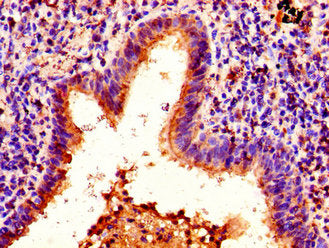 HIST1H1E (Ab-63) Antibody