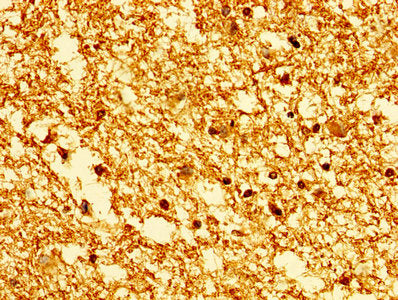 HIST1H1E (Ab-63) Antibody