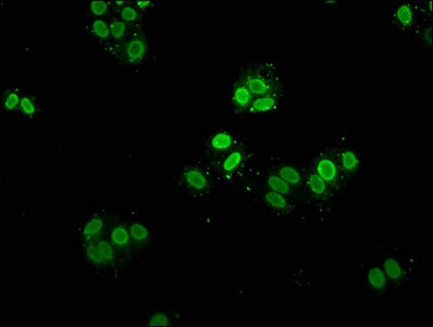 Mono-methyl-HIST1H2AG (K9) Antibody