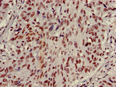 HIST1H3A (Ab-27) Antibody