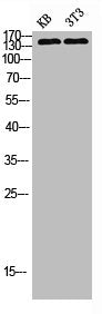 PLCG2 Antibody