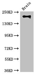 ITGB4 Antibody