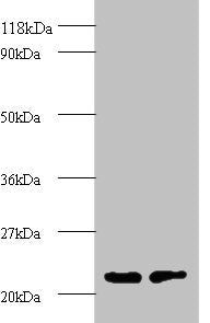 PSMB2 Antibody