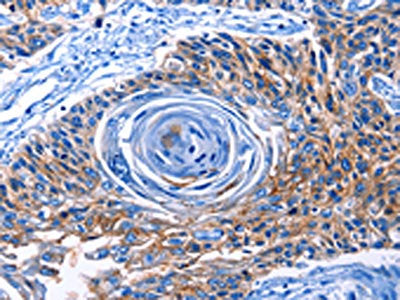 CLEC2B Antibody