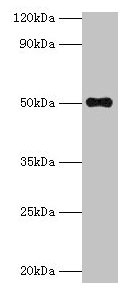 TMLHE Antibody