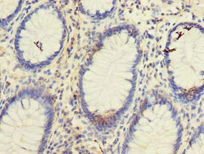 TSPAN1 Antibody