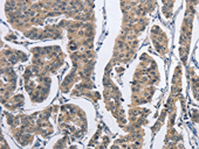 DSG2 Antibody