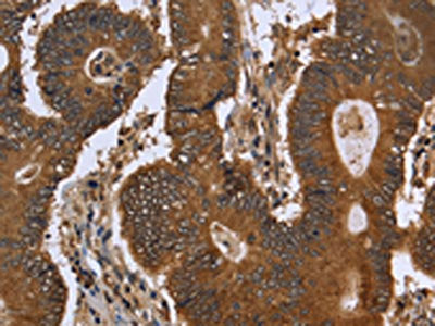 FGFRL1 Antibody