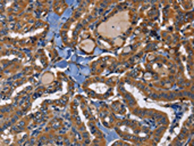EPHB6 Antibody