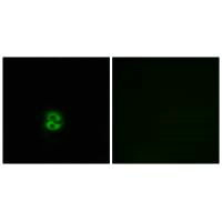 CHST6 Antibody