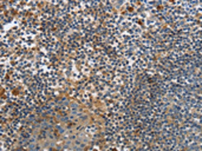 PAK4 Antibody