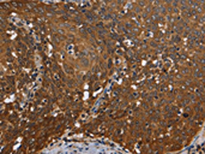 REL Antibody