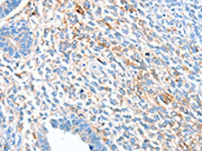 ALDH1A2 Antibody