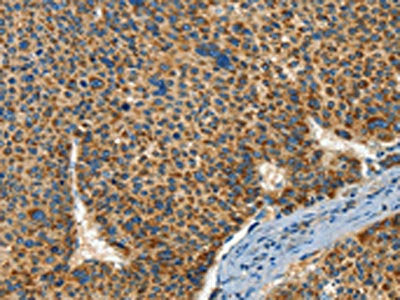 IFT74 Antibody